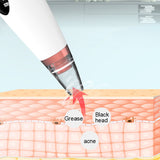 6 in 1 Electric Blackhead Remover | BUY FROM T