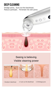 Electric Visual Blackhead Apparatus with WiFi HD Camera | BUY FROM T