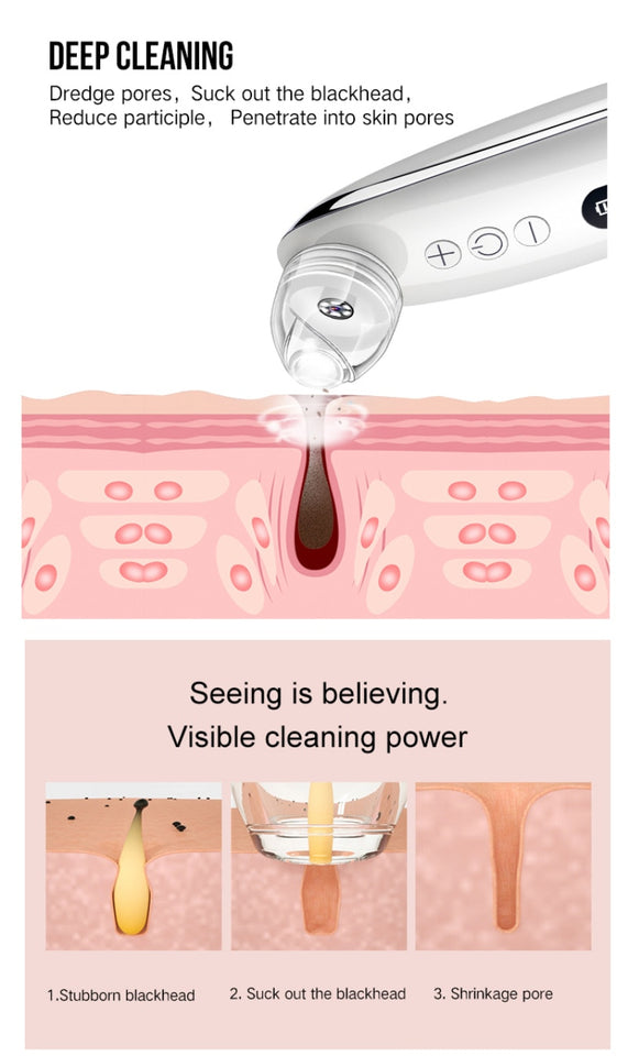 Electric Visual Blackhead Apparatus with WiFi HD Camera | BUY FROM T
