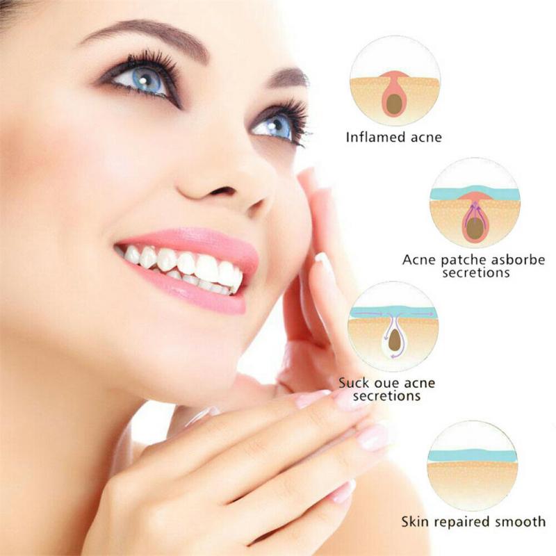 36pcs  Pimple Master Patch Acne Treatment | Buy From T