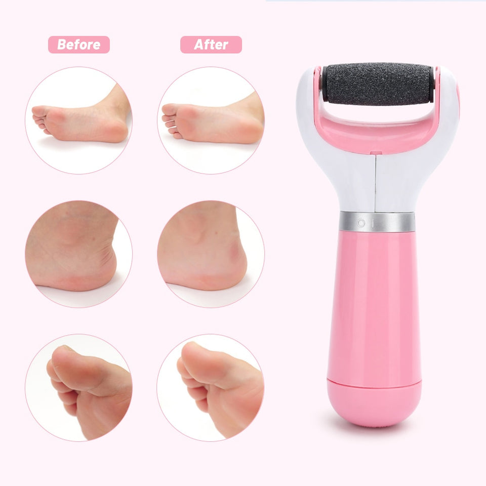 Portable Electric Foot Heel Care Tool | Buy From T